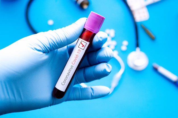 Rapid Antibody-Based Blood TestsFor Covid-19 | SIMS Hospital